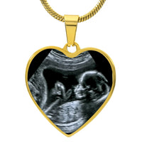 Thumbnail for Ultrasound Heart Neckalce - Love You This Much